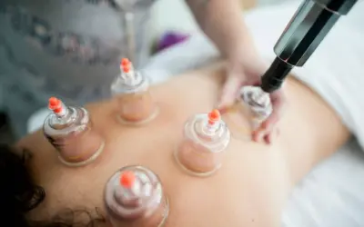 Graston Therapy vs. Cupping: Which One Is Better for Muscle Recovery?
