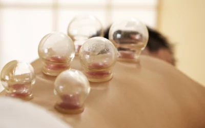 Cupping Therapy Dangers: What You Should Know Before Your First Session