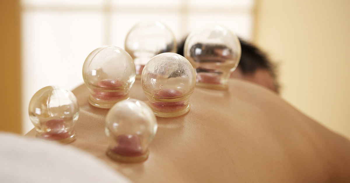Cupping Therapy Dangers
