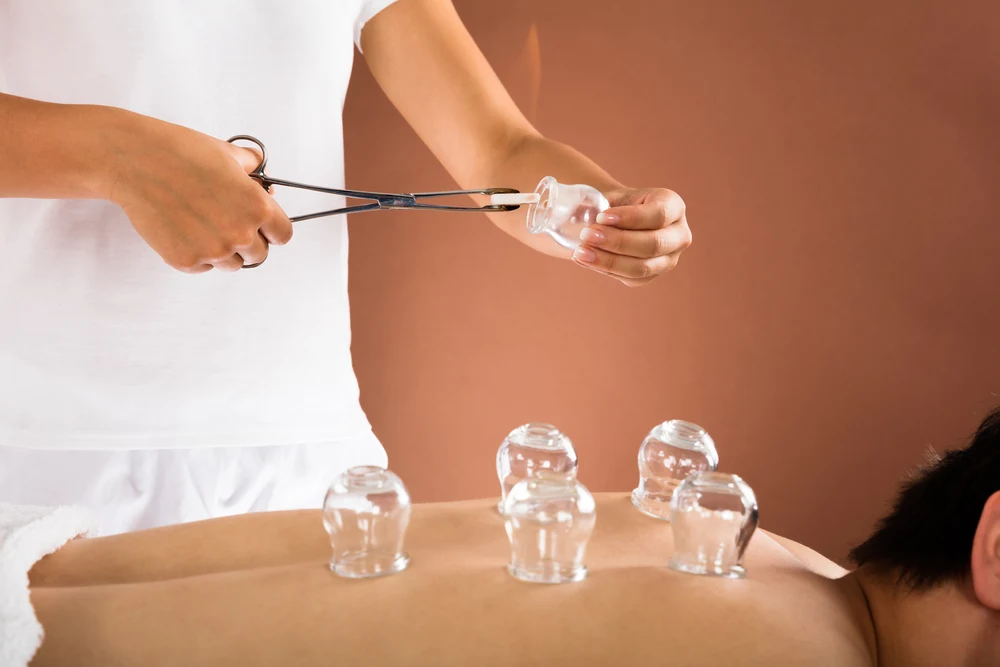 The Dangers of Cupping
